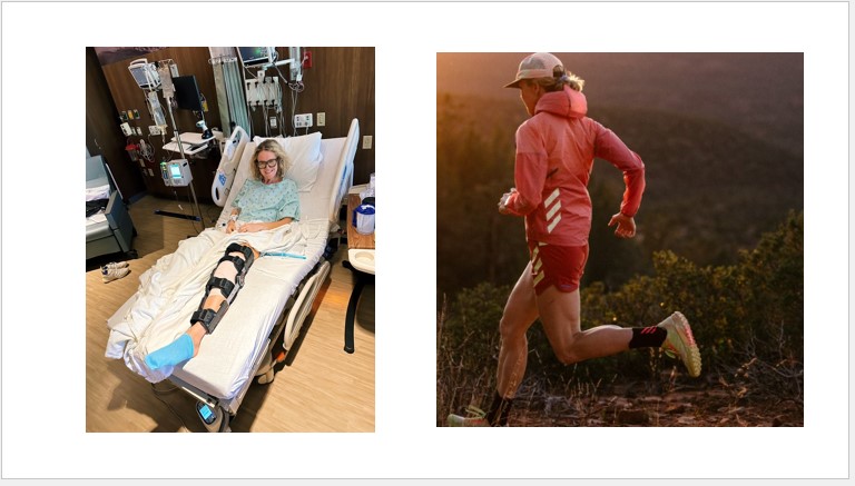 PROFILE: When the Trail Became Rough for Pro Ultra Runner Abby Hall, Seriously Injured in 2023, She Just Became Tougher